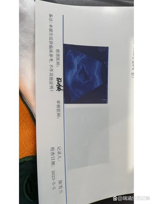 移植后45天