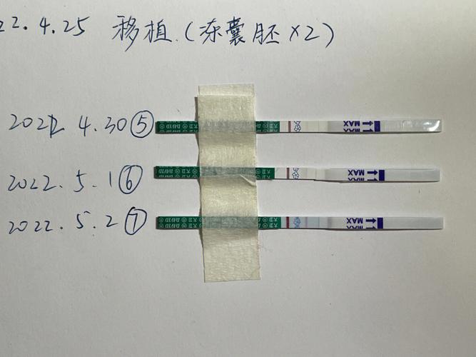二代囊胚移植