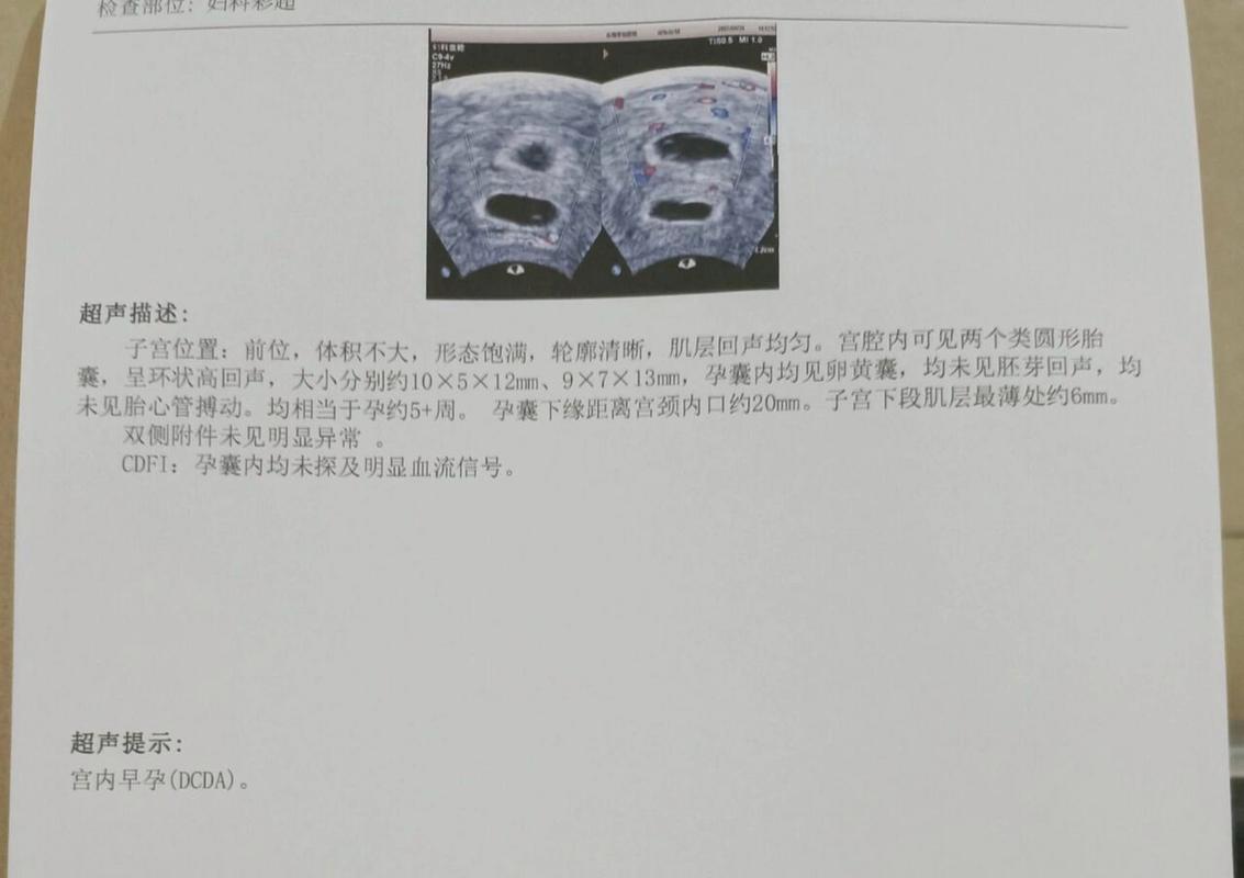移植18天