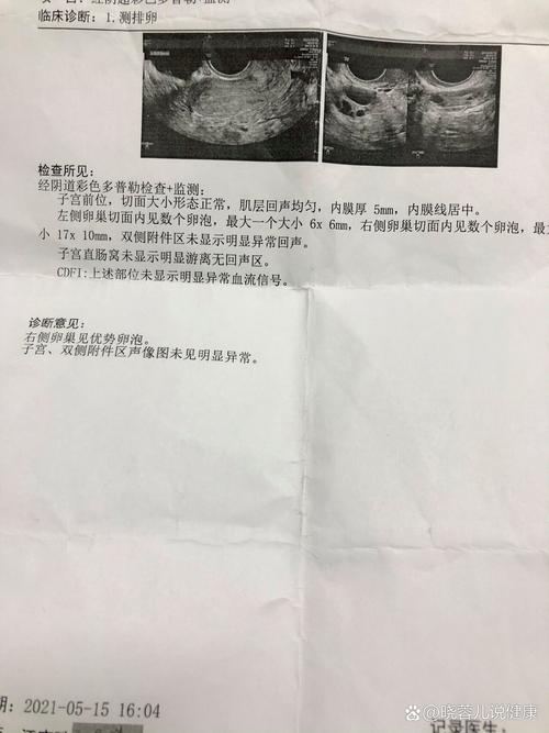 卵泡张力欠佳