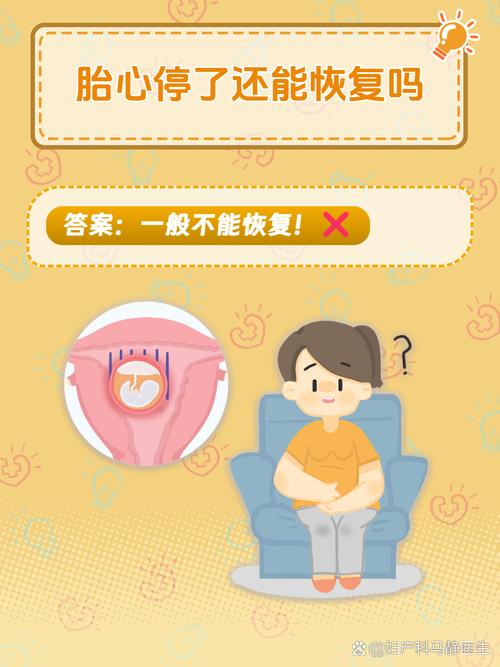 胎心偷停