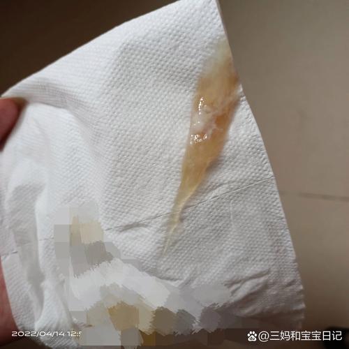  白带见红