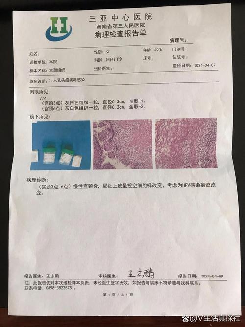 活检难易程度