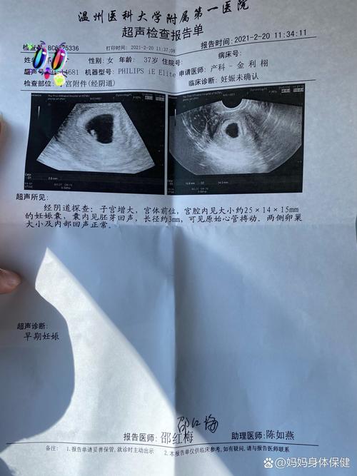 五周胎心