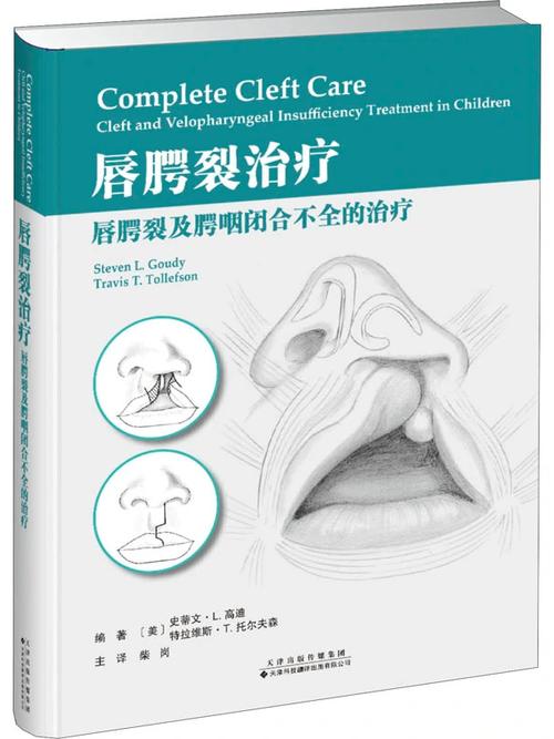 唇腭裂治疗