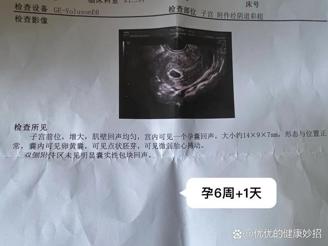 6周胎心微弱