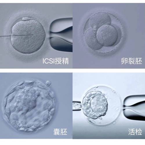 第三代胚胎检测