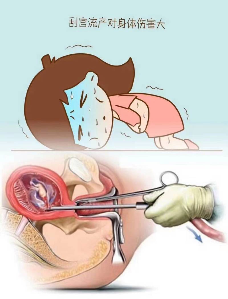 人工调内膜