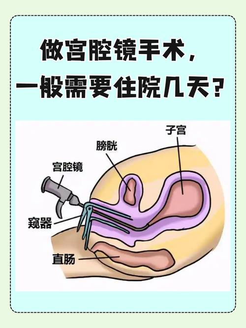 宫腔操作