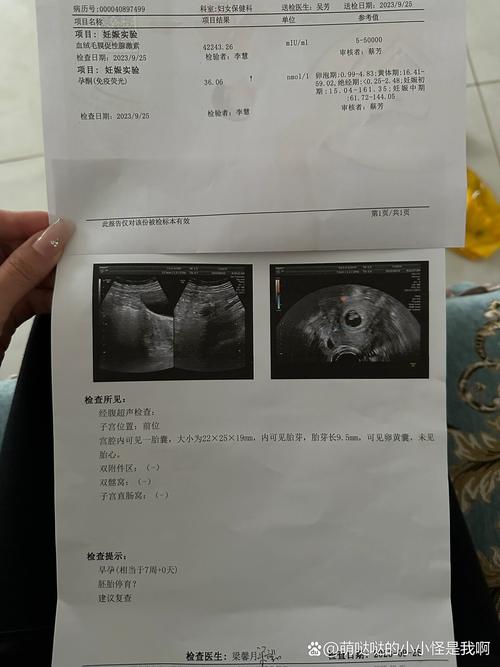 8周无胎心