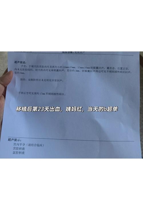 移植26天症状