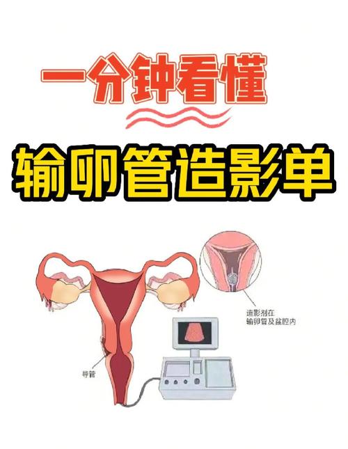 输卵管要求