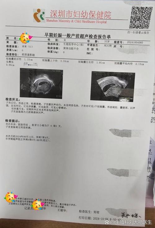 单胎试管婴儿
