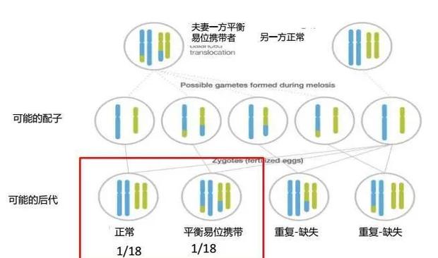 染色体平衡异位
