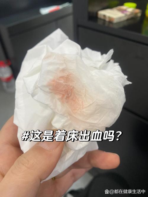 着床后积血