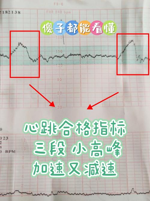 胎心率测量
