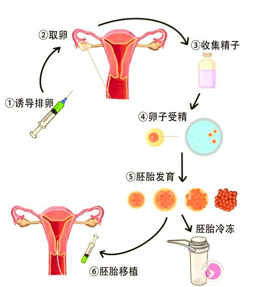  试管过程