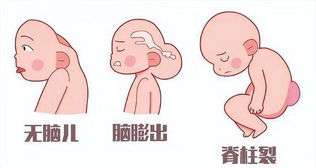 胎儿发育异常