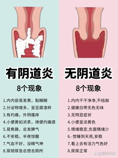 生殖系统问题