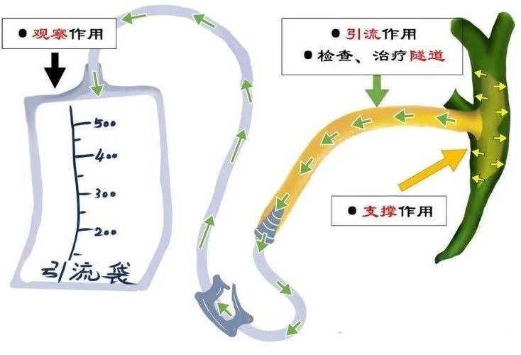  FET术