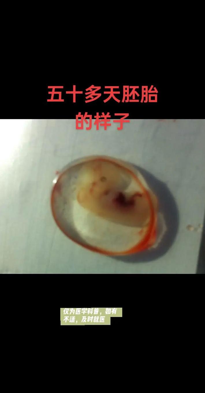 库存胚胎