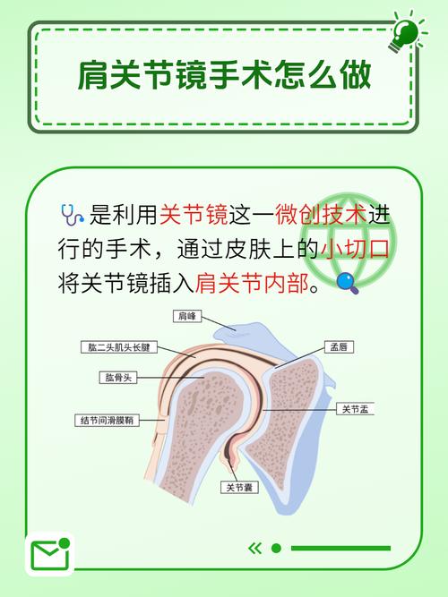  微创方案