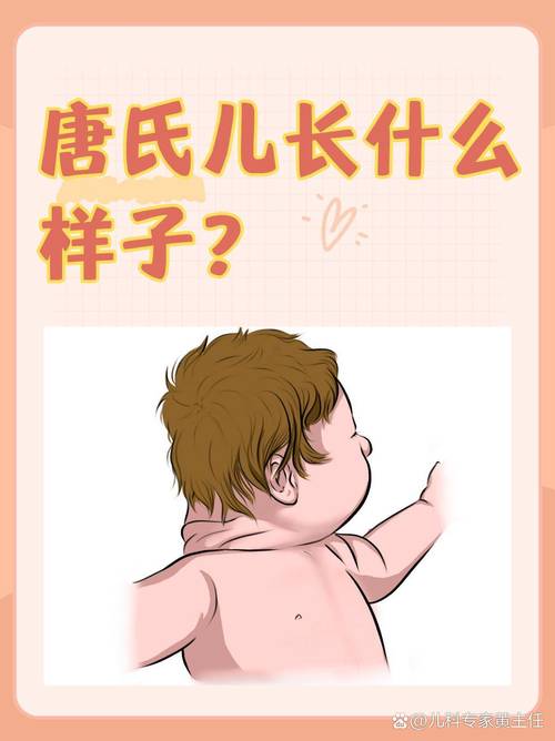  先天性异常
