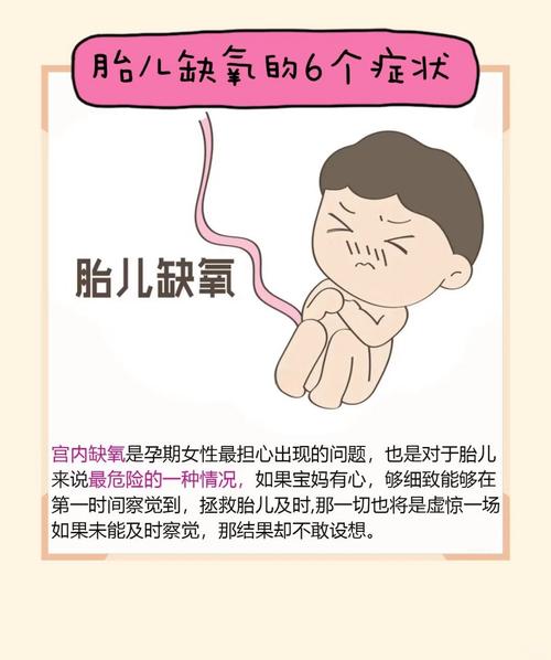 胎儿缺氧