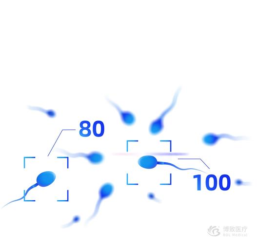  精子优选