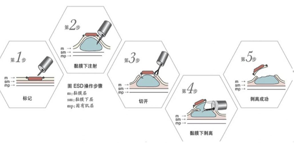 手术历程