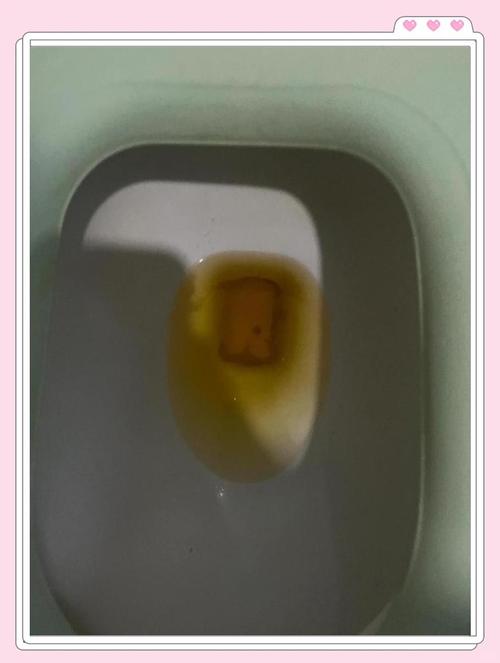 尿液变黄
