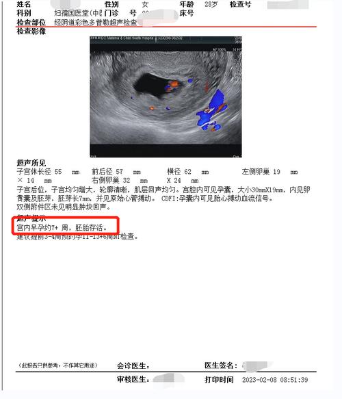 取不到卵泡