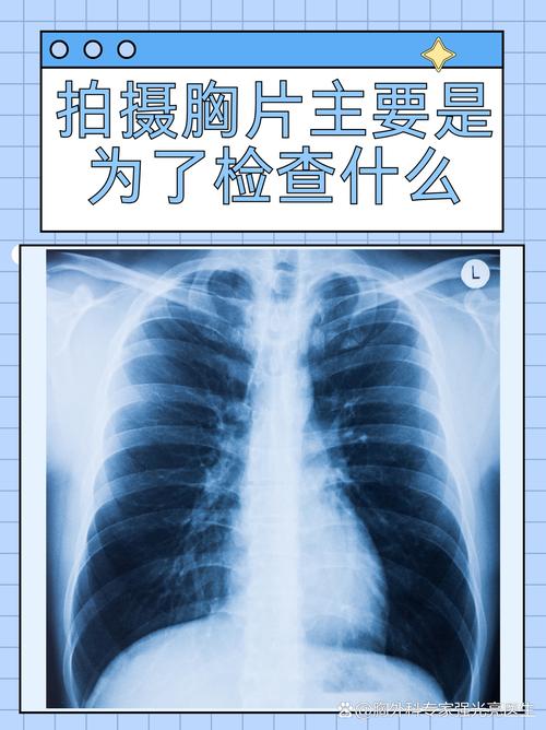  胸透检查
