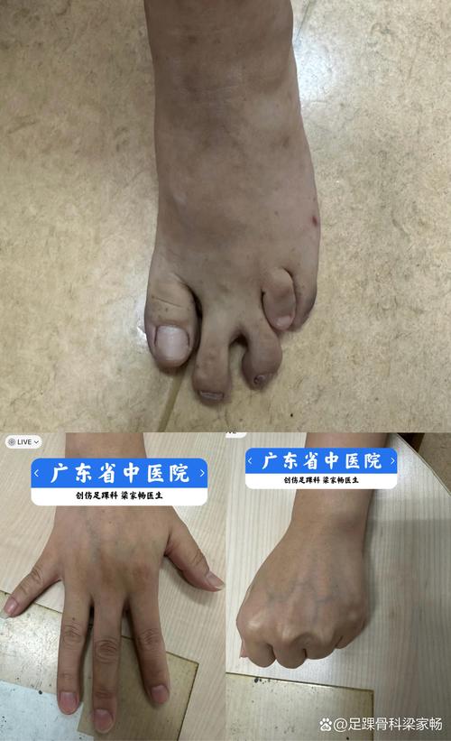 多发畸形