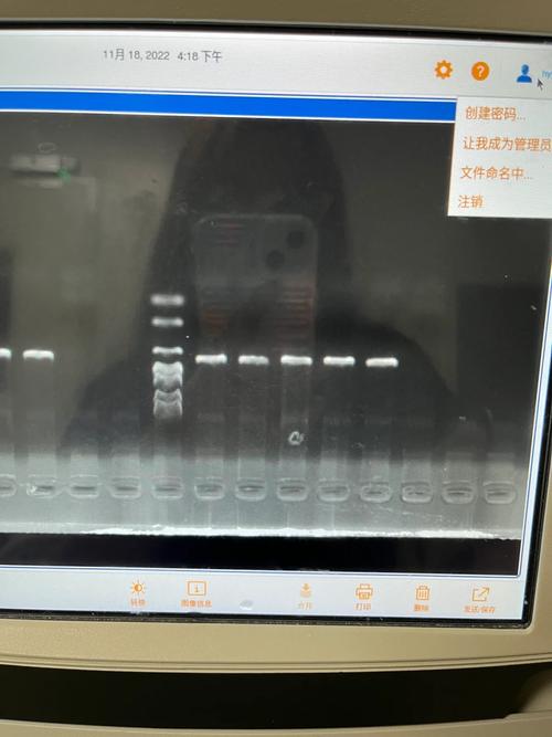 基因检查失败