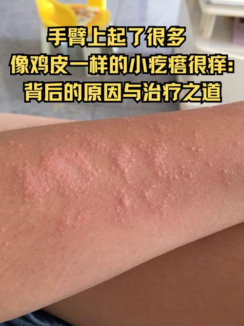  小疙瘩