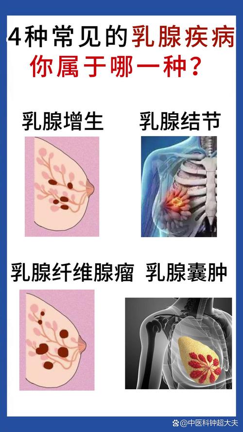 乳腺疾病