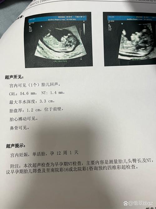 NT值7.5