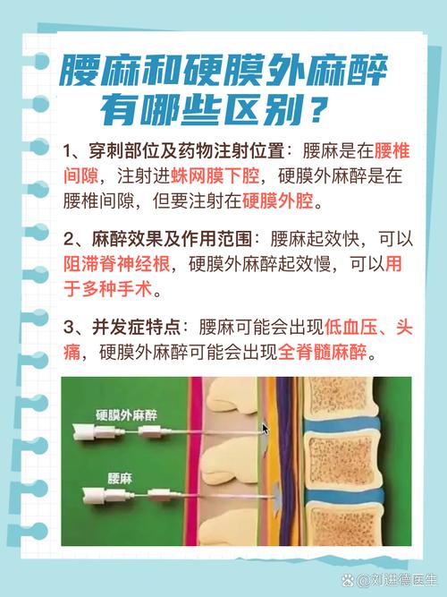  麻醉方式