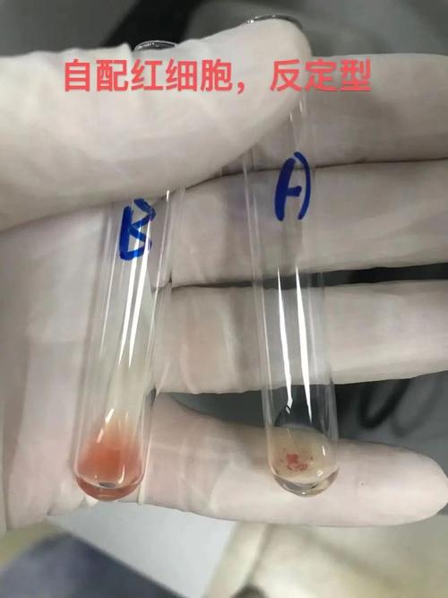 ABO试管