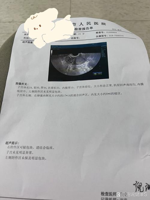 宫外孕诊断