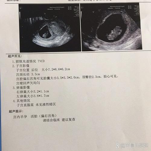 子宫偏右