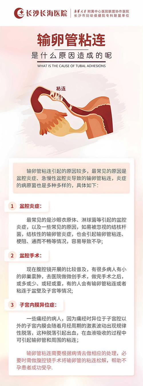  输卵管不孕