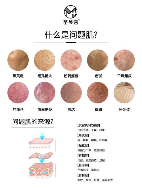  皮肤问题