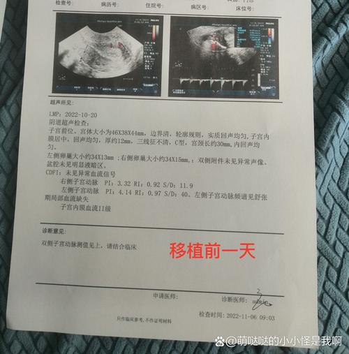 移植后28天