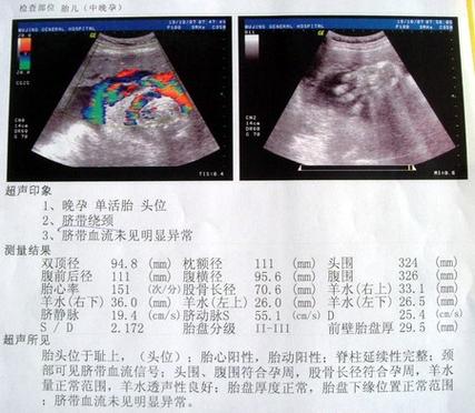 23天B超检查