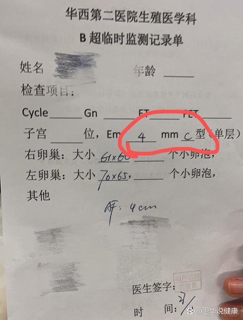 移植前转化