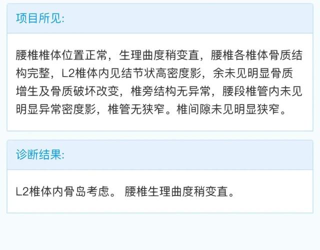  强直排除