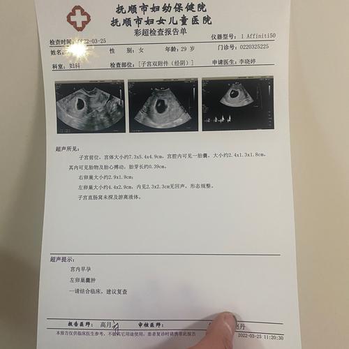 移植25天