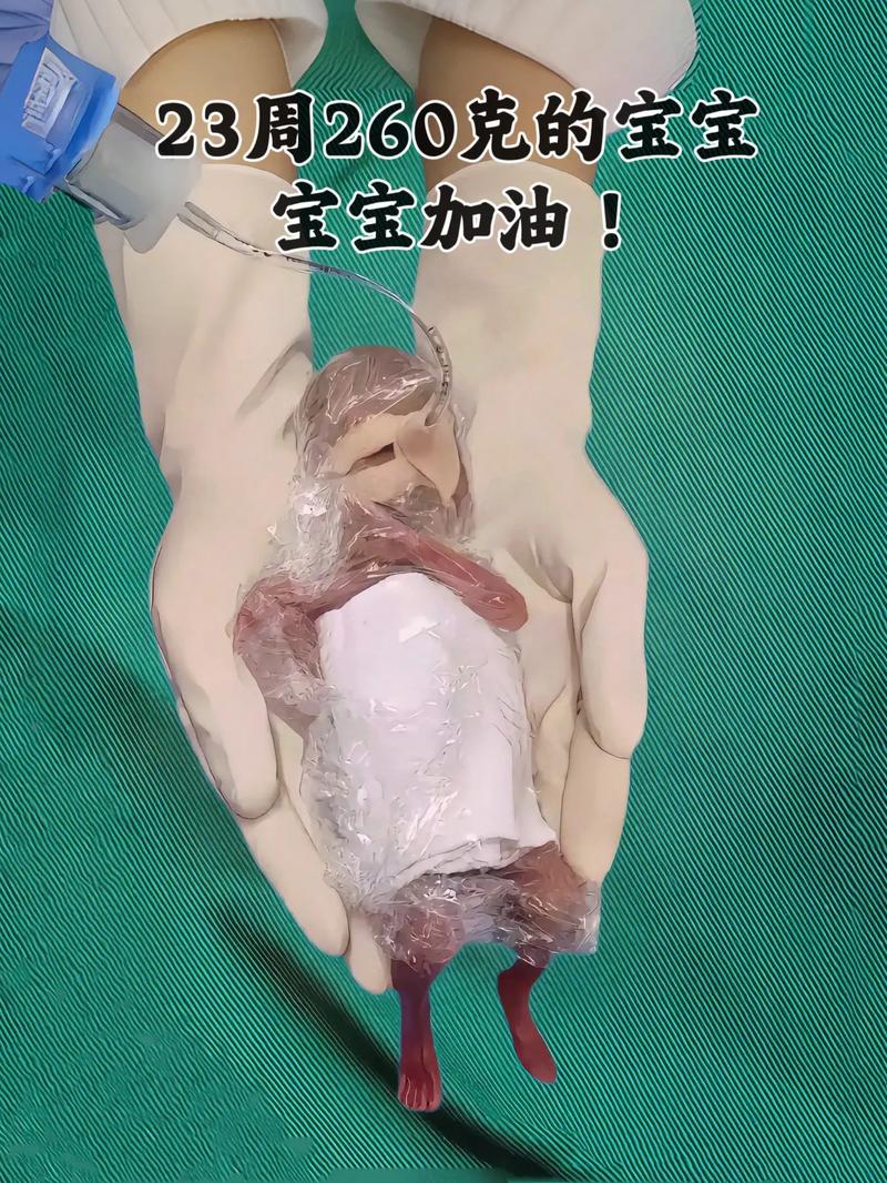 移植二周